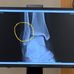 Bennett, Aaron Dr - Munson Healthcare Manistee General Surgery - Facebook