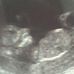 Aaron Turnock - Facebook