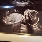 Abbie Knowles - @abbie_knowles261095 - Instagram