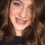 Abby Rhoads - @abbylovessydnie - Instagram