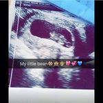 Abigail - @abigail.laing.elsie.lewis - Instagram