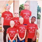 La Fondation Adja Nabintou Kone pour les Albinos - Facebook