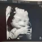 Aiden Galvan - Facebook