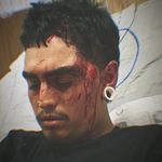 Albert Lino - @ratchetskates_ - Instagram