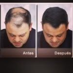 Alberto Duque - @fullyhair_colombia - Instagram