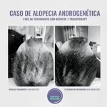 Alfredo Arias - @territoriocapilar - Instagram