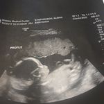 Alisha Stephenson - @alisha.stephenson.737 - Instagram