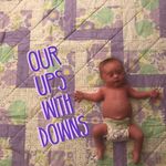 Alison Hoffman - @ourupswithdown - Instagram