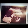 brentonallenstringfellow - @brentonallenstringfellow - TikTok