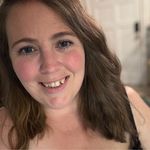 Allison Doran - @albinoallison - Instagram