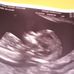 Amanda Protheroe - Facebook