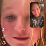 Shelly and Amber - @shamber_kneesurgery - Instagram