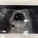 Natalie Amelia Barclay - @babynataliebarclay - Instagram