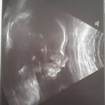 Amelie Lyra Werner - @s.p.a.t.z.i - Instagram