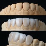 Andrea Rubio | Laboratorista Dental - @lab_andrearubio - Instagram