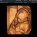 Angie Boyce - Facebook