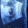 Zoeanneearle - @zoeearle2022 - TikTok