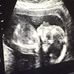 Dr. Annette F. Mayes, M.D., PC Obstetrics &amp; Gynecology - Facebook