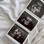 𝑨𝑵𝑵𝑰𝑬 & 𝑬𝑹𝑾𝑰𝑵 - @babys_da_ibarbz - Instagram