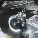 @lebron_annie.2449 - Instagram