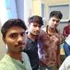 Abhi Singh Darokhriy - @anshumanshah14 - TikTok