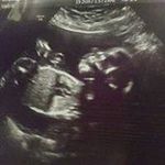 Anthony Aldridge - @anthony.aldridge1987 - Instagram