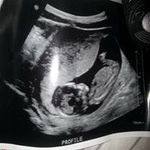 Antonio Dillard - @dillardantonio - Instagram