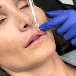 Ariel Berman - @bringmebotox - Instagram