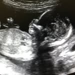 @arlo_stone2 - Instagram