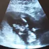 Audreyalessio - @megaalessio2018 - TikTok