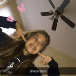 Brace Face❤️😂🤙🏻✨ - @bailey._.keck4 - Instagram