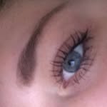 Bailey Martinez - @bailey_spiderma - Instagram