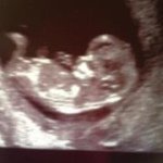 Becky Maher - @bexstermaher - Instagram