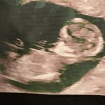 Ben McAdam - @lentil2019 - Instagram