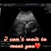 Ben Sherrill - Facebook
