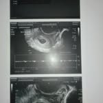 Benjamin Alexis - @rociobenjamin601 - Instagram