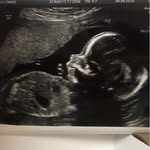 Baby Bertie Gibson - @babyboogibson - Instagram