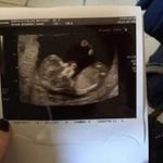 Bethany Fields - @bethany.fields.9400 - Instagram