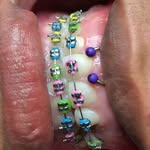 Bobby Braces - @bobby_braces20k - Instagram