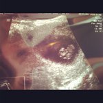@menardbrandon - Instagram