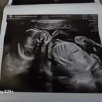 Brandon Tuley - Facebook