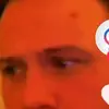 briancarlsens_adderallacne - @byebriancarlsen - TikTok