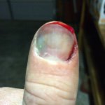 Brian Klotz - @bklotz71 - Instagram