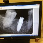 Brian Polillo - @brianpolillodds - Instagram