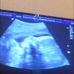 Bryan Medeiros 👶🏼💙 - @bryan_medeiros_0 - Instagram