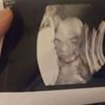 Brian Nickerson - @briannickerson49 - Instagram