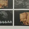 .... - @bryantenorio4 - TikTok