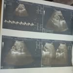 Caleb Arthur💙👣 - @_.caleb_arthur_ - Instagram
