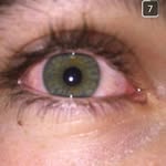 Caleb Stoner - @spuederman - Instagram