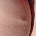 Las Vegas Skin &amp; Cancer CLNCS - Candace Spann MD - Facebook